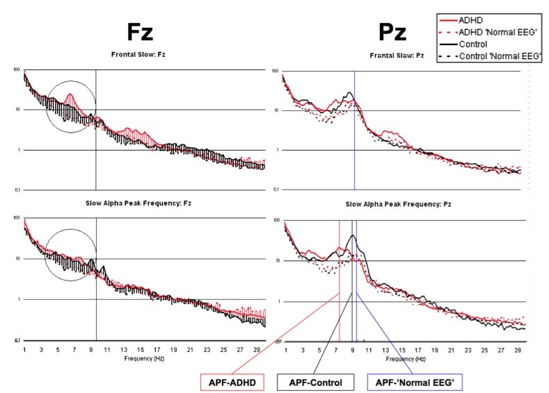 EEG phenotypes and alpha frequency