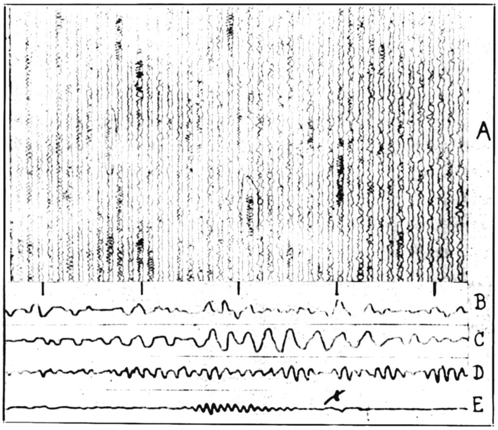 loomis_first_eeg, from the book Neurofeedback, how it all started, by Martijn Arns and Barry Sterman